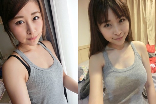 隆乳,台中隆乳,台中絨毛隆乳,台中隆乳推薦,台中果凍隆乳推薦,台中矽膠隆乳推薦,台中水滴隆乳推薦,台中水滴型隆乳推薦,台中果凍矽膠隆乳推薦,台中水滴型果凍矽膠隆乳,台中隆乳費用,台中果凍隆乳費用,台中矽膠隆乳費用,台中隆乳價格,台中水滴型隆乳價格,台中果凍矽膠隆乳價格,台中隆乳介紹,台中果凍隆乳介紹,台中矽膠隆乳介紹,台中果凍矽膠隆乳介紹,台中隆乳分享,台中水滴型隆乳分享,台中果凍矽膠隆乳分享,台中隆乳診所,台中果凍隆乳診所,台中隆乳醫師,台中水滴型隆乳醫師,台中果凍矽膠隆乳醫師,台中隆乳權威,台中果凍隆乳權威,台中矽膠隆乳權威